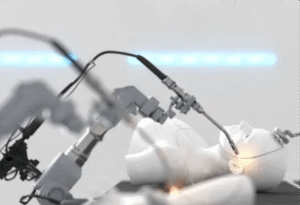 Robotic surgery